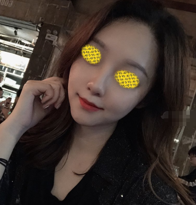 上海德琳朱麟面部吸脂果怎么样？