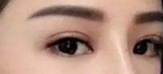 广州华美做脂肪填充怎么样?