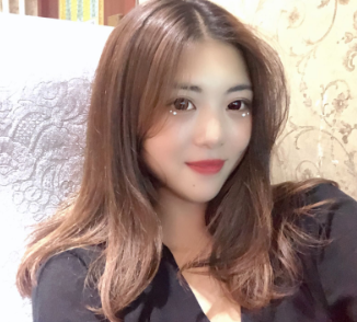 郑州爱美丽整形医生崔黎丹做的双眼皮太美了!