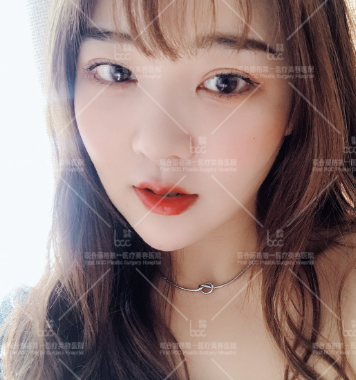 北京联合丽格第一医疗美容医院胡晓焕面部埋线提升