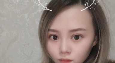 天津亦可美客医疗美容全切双眼皮怎么样?