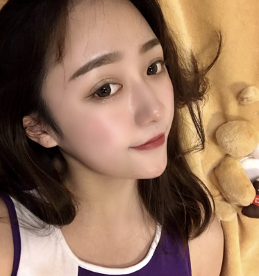 温州和平整形医院梁赞姜医生做的鼻子果