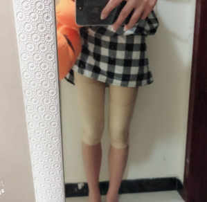 北京星医汇整形大腿吸脂怎么样?