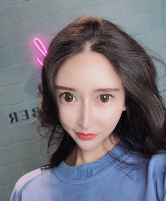 上海愉悦美联臣医美医院下颌角整形怎么样?