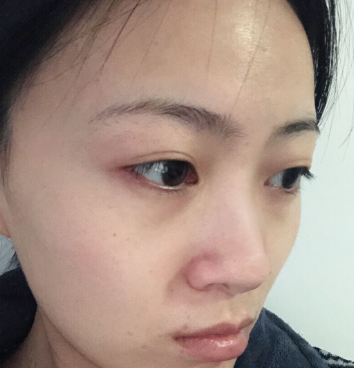 重庆当代整形美容医院隆鼻果怎么样?