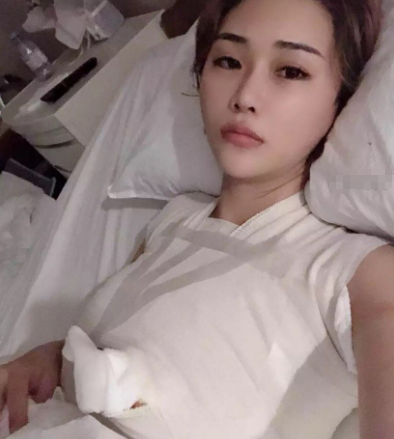 北京美莱医疗美容假体隆胸果怎么样？案例