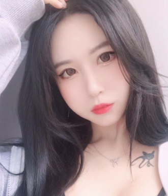 杭州艾丽娅医疗美容下眼下至术案例分享!
