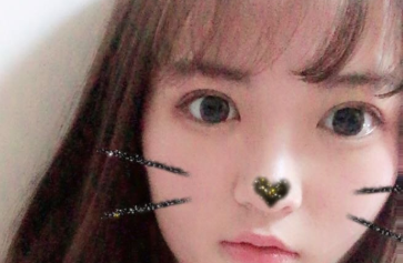 温州伯思立医生邹仙娥眼部多项案例分享!