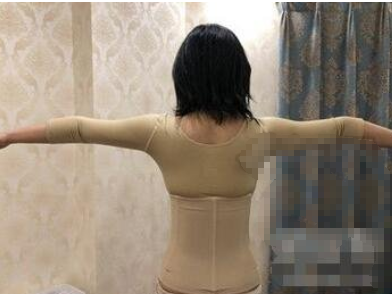 武汉新志美医美医院全身抽脂恢复果怎么样？