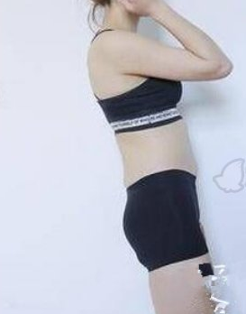 武汉伊美馨整形全身吸脂案例分享!