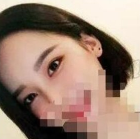 上海九院美容科医生朱海男眼角修复案例分享!