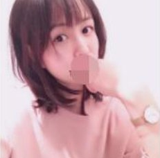 武汉美天医美脸部玻尿酸填充案例分享!
