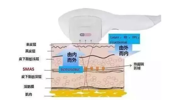 脸部的超声提拉和眼部的热玛吉多少钱？