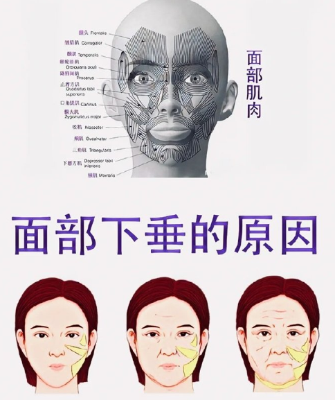 小切口拉皮除皱果怎么样？
