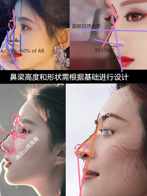 什么样的人适合做少女感的鼻子?