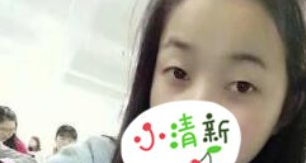 成都天使之翼医美切开双眼皮怎么样?