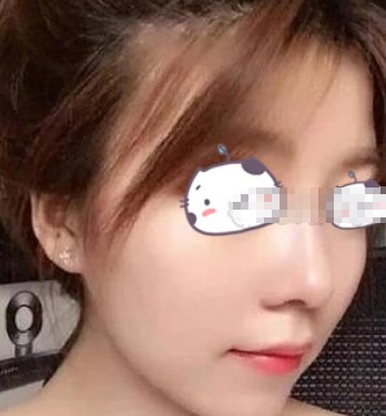 南方医科大学珠江医院医生蒋海军鼻部手术术后
