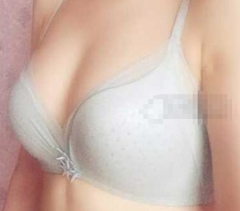 郑州天后医疗美容医院自体脂肪隆胸果怎么样