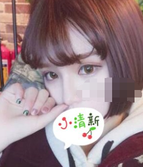阜新安琪美医美医生何祯平鼻部手术案例