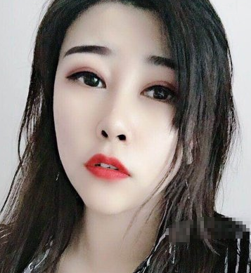 上海光博士医美医生彭春热玛吉果好不好?