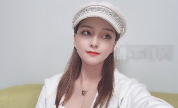 id整形医院医生李知赫颧骨颧弓整形术案例分享!