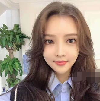 深圳南雅医疗美容医生张颖杰面部吸脂案例分享