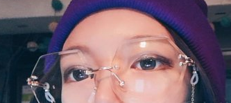 沈阳沈河创美医疗美容医生张辉眼部手术案例分享