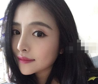 重庆时光整形美容医院鼻部手术案例分享