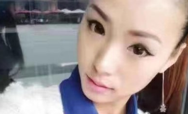 成都寻美者在锦江纽蜜康医生做的鼻子如何?