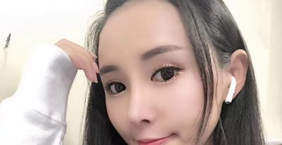 成都寻美者在锦江纽蜜康医生做的鼻子如何?