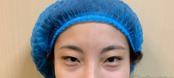 美诗沁去眼袋真靠谱吗?上海MM感受分享