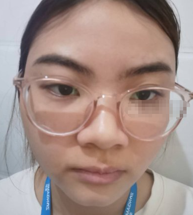 重庆寻美者珂琳雅医美激光祛斑怎么样?