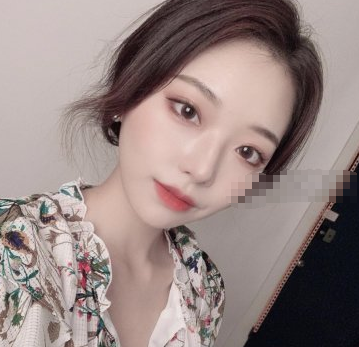 北京妹纸在YS PLUS妍世护肤光子嫩肤果分享