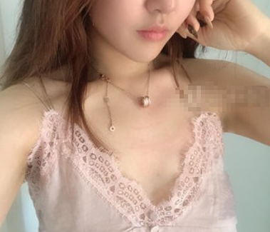 无锡坤如玛丽医院王义医生隆胸果好吗?