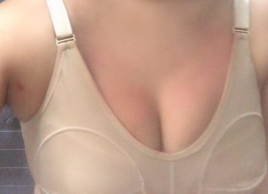 北京润美玉之光好吗?张红芳隆胸可靠吗?