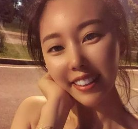 李轶璞整牙好吗?深圳阳光医院隐形矫正案例分