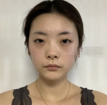 重庆医佑美曾志权医疗美容面部填充靠谱吗?