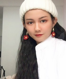 重庆光博士陈健医生自脂丰面颊果咋样?