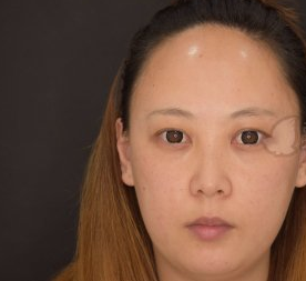 成都美绽美整形好不好?半长期纹眉案例有吗
