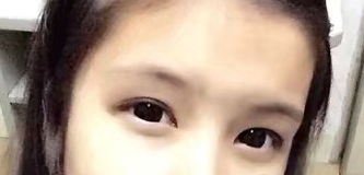 广东韩妃整形半长期纹眉案例带对比图分享