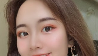 小姐姐北京眼部手术感受分享 华悦府张鹏案例