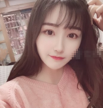 北京妹子华悦府医美眼部手术案例分享附带果图