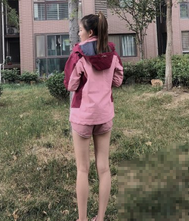 重庆鹏爱医疗美容医生邹礼西吸脂能瘦大腿吗?