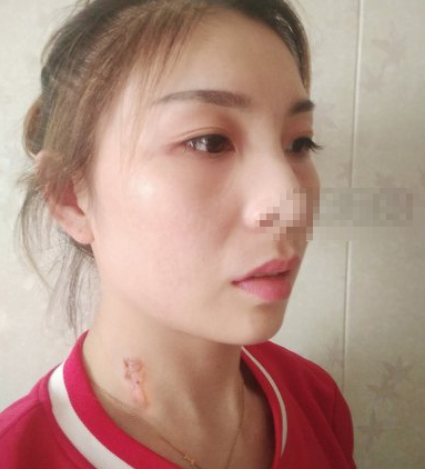 成都医大疤痕研究院激光祛疤果好吗?