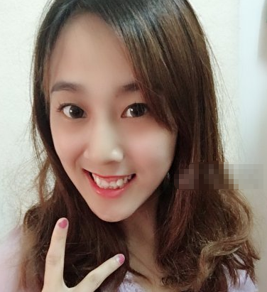 合肥华美医院红蓝光祛痘怎么样?案例实测