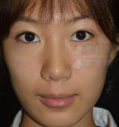 长沙晶肤医疗美容射频美肤果怎样?