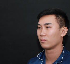 徐荣阳隆鼻好吗?深圳男孩艾妍肋软骨隆鼻案例