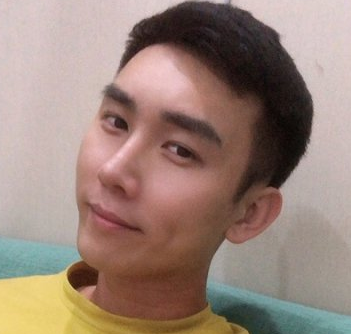 徐荣阳隆鼻好吗?深圳男孩艾妍肋软骨隆鼻案例