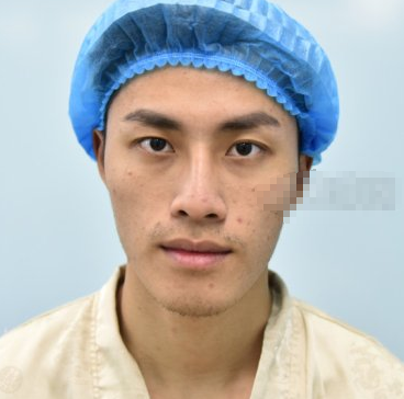 男模找深圳美莱的梁晓健隆鼻分享附带果图