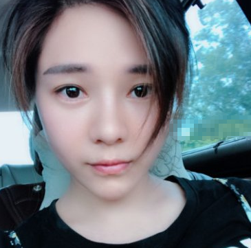 深圳美莱医疗美容医生梁晓健鼻部手术案例分享